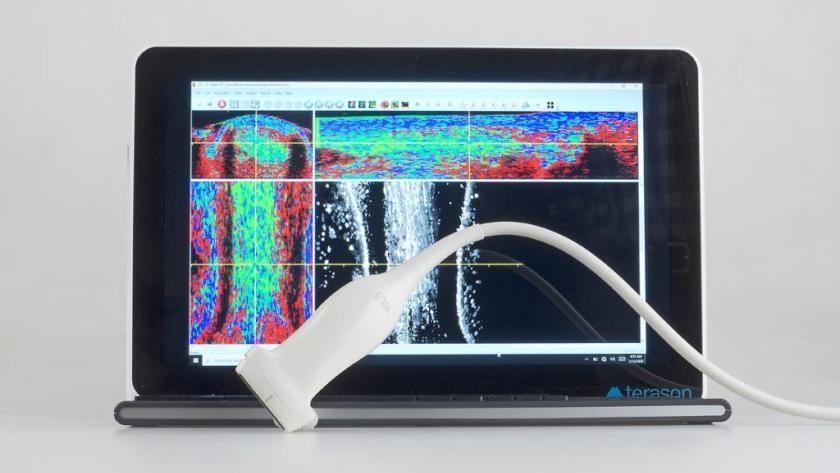 UTC imaging ultrasound scanner