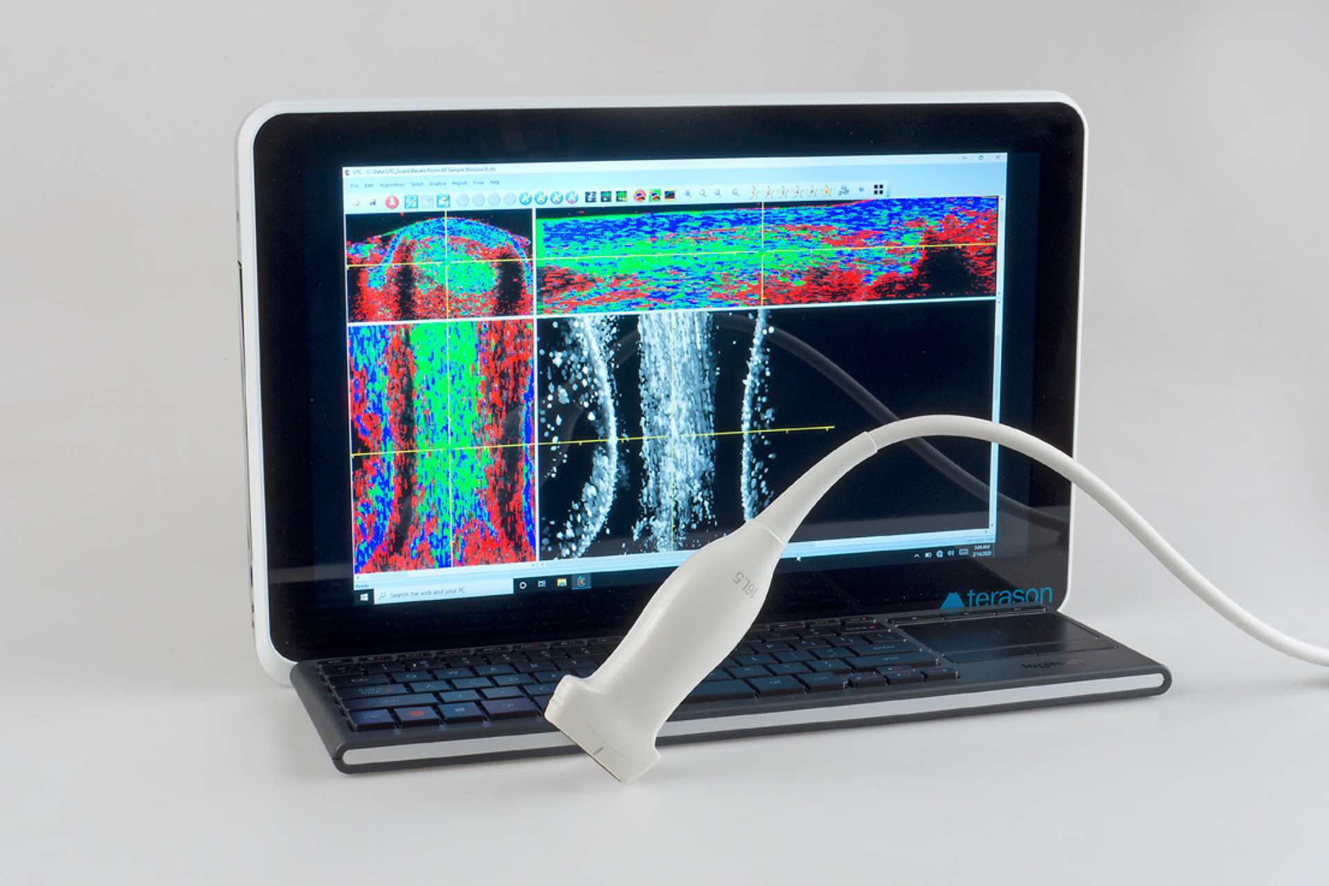 State-of-the-art Ultrasound